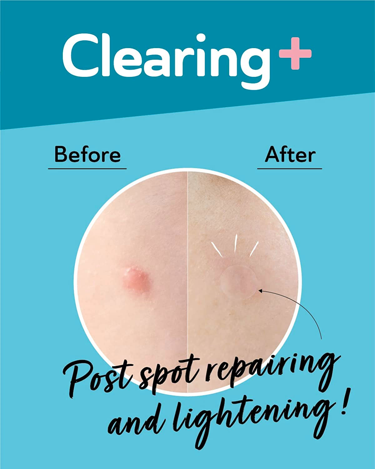 Dermaangel Ultra Invisible Dark Spot Patches Lightening Health & Beauty DermaAngel   